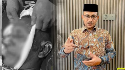 Haji Uma Meminta Polda Aceh Serius Tangani Kematian Warga Aceh Utara yang Diduga Dianiaya Oleh Oknum Polisi