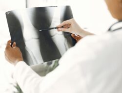 5 Tips Pencegahan Osteoporosis untuk Tulang Kuat